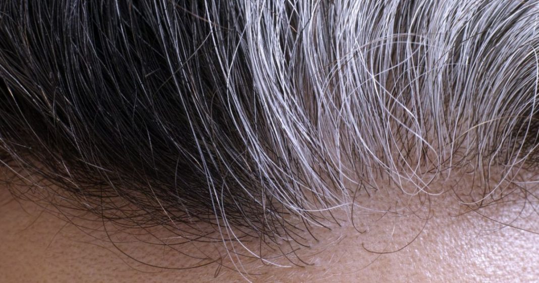 Tipos de canas