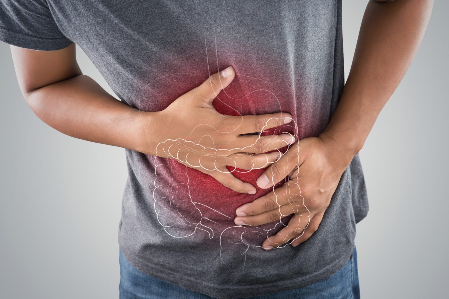 Diagnóstico del síndrome del intestino irritable
