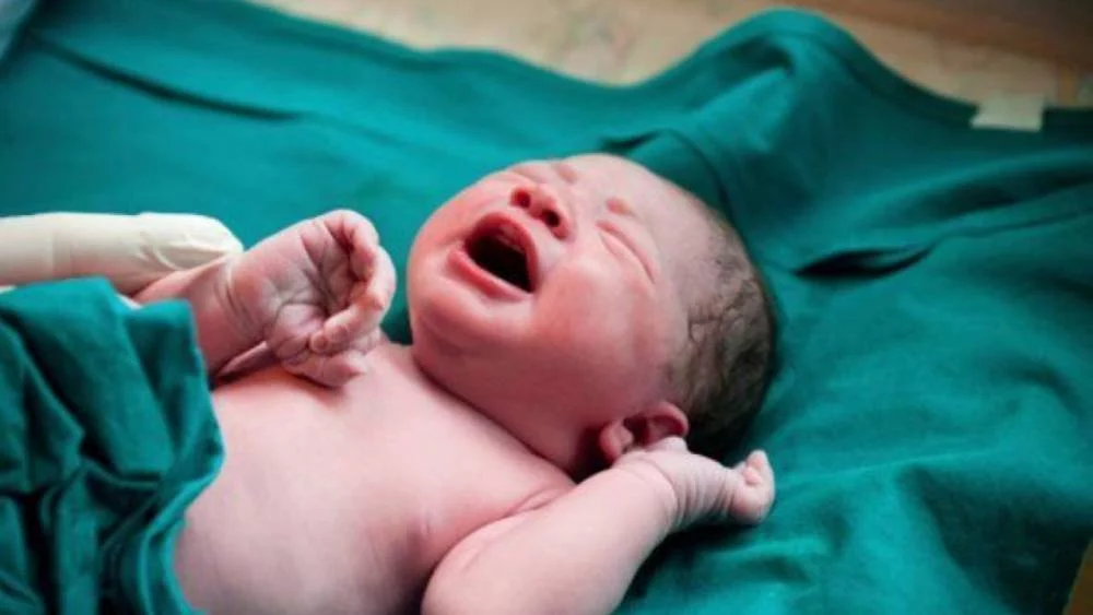 Como la mujer sirena: un bebé nació en la India con una extraña condición