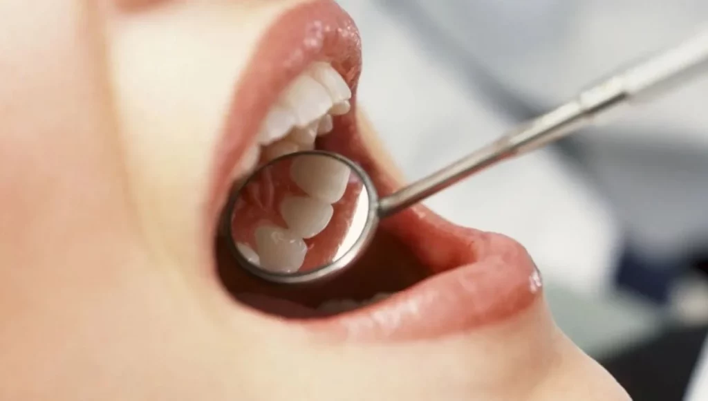 Estos son los secretos para tener dientes blancos