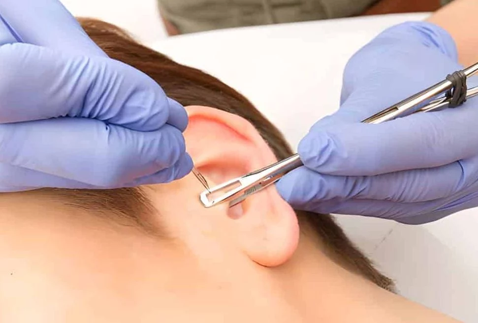 ¿Es seguro usar el daith piercing para acabar con las migrañas?